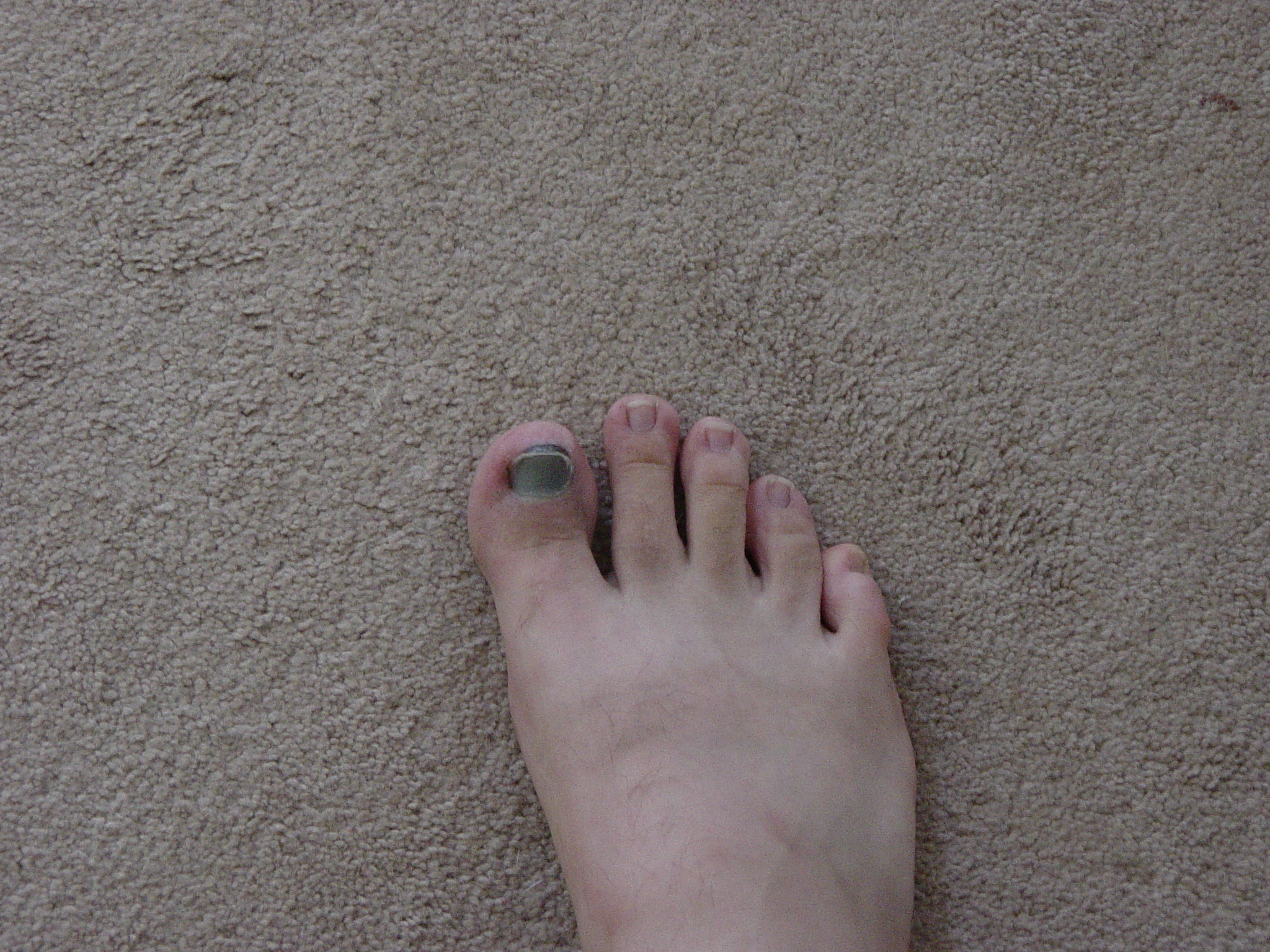 My toe.  Hurt it last week.  Ow!